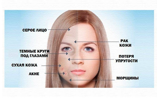 Симптомы